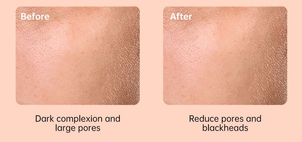 38c37aa1a167955e9529436fc62227c4 38c37aa1a167955e9529436fc62227c4